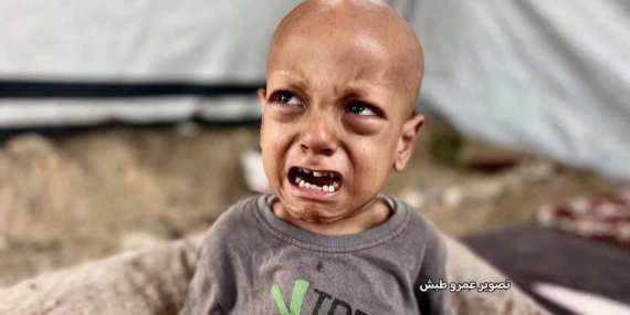 Gazze’den Türkiye’ye getirilen 5 yaşındaki Abdullah yaşamını yitirdi