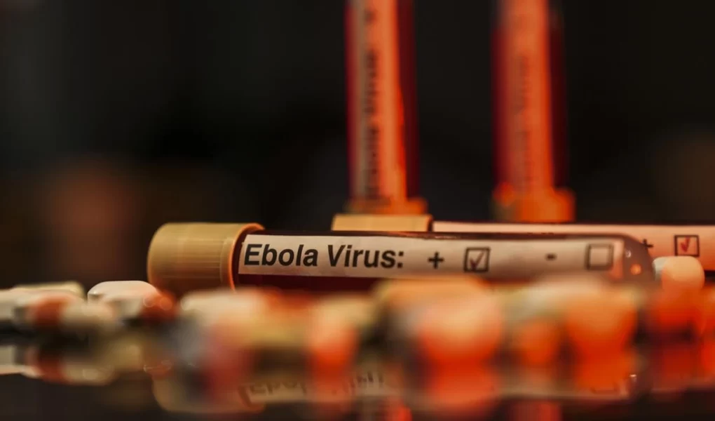 Ebola salgını KDC ekonomisini vurdu: 1 milyon kişi yoksullaşacak