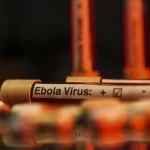 Ebola salgını KDC ekonomisini vurdu: 1 milyon kişi yoksullaşacak