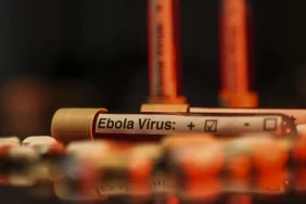 Ebola salgını KDC ekonomisini vurdu: 1 milyon kişi yoksullaşacak