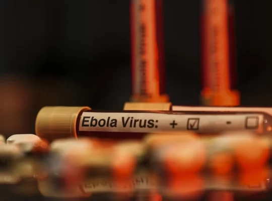 Ebola salgını KDC ekonomisini vurdu: 1 milyon kişi yoksullaşacak
