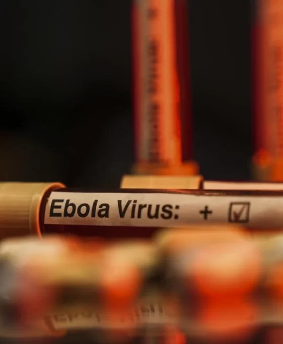 Ebola salgını KDC ekonomisini vurdu: 1 milyon kişi yoksullaşacak