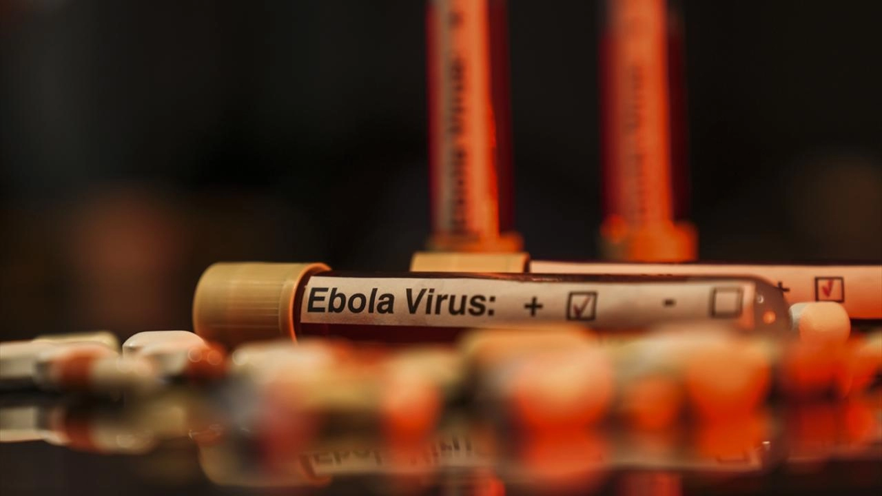 Ebola salgını KDC ekonomisini vurdu: 1 milyon kişi yoksullaşacak