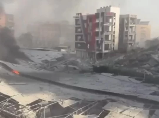 İsrail hastaneyi vurdu: Yoğun bakımda oksijen kesildi!