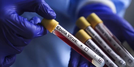 İsrail’de Ebola alarmı: İlk kez bir kişi karantinaya alındı