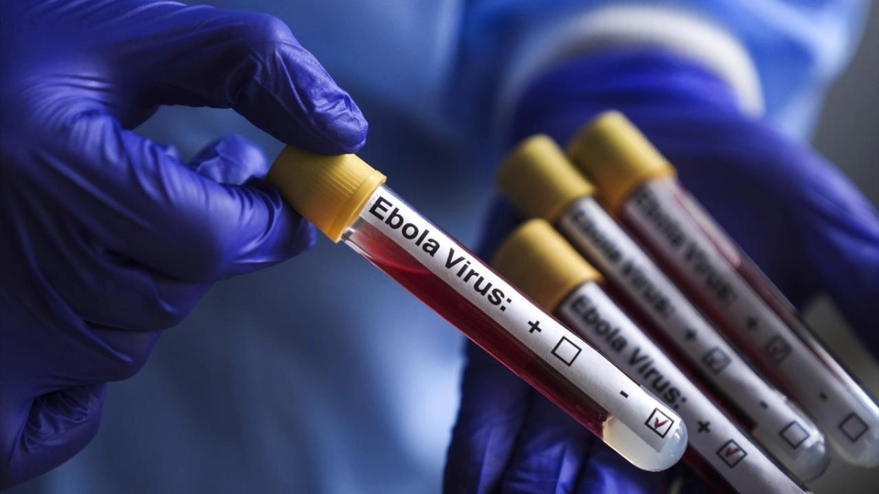 İsrail'de Ebola alarmı: İlk kez bir kişi karantinaya alındı