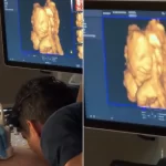 Ultrasonda şaşırtan gülümseme: Bebek babasının sesine mi tepki verdi?